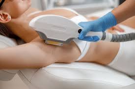 laser-hair-removal-underarms